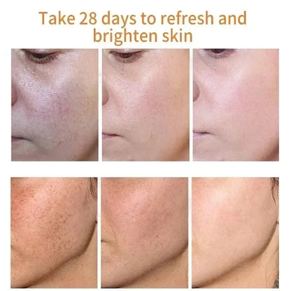 Fades Freckle Dark Spots Face Cream Niacinamide Whitening Cream Vitamin E Improve Dullness Fast Brighten Nourish Skin Care - DropZzzone