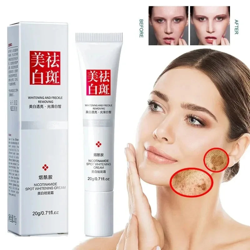 Fades Freckle Dark Spots Face Cream Niacinamide Whitening Cream Vitamin E Improve Dullness Fast Brighten Nourish Skin Care - DropZzzone